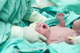 עו"ד נעמי קויפמן ניב I תביעות רשלנות רפואית I רשלנות רפואית בהריון ולידה